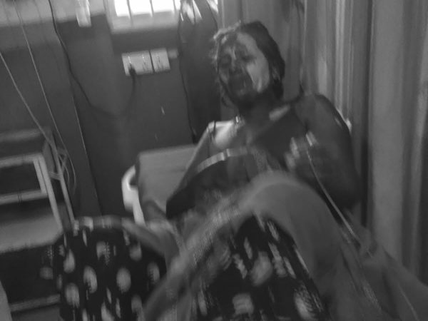 श्रीमतीलाई पेट्रोल छर्केर आगो लगाउने श्रीमान् प्रहरी नियन्त्रणमा